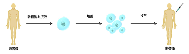 幹細胞移植